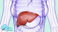 کبد چرب؛ بیماری پنهان و مرموز اما کشنده! +راه درمان
